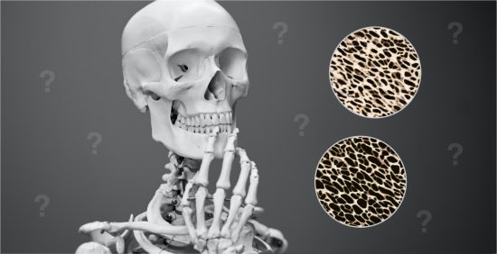 cbd oil osteoporosis